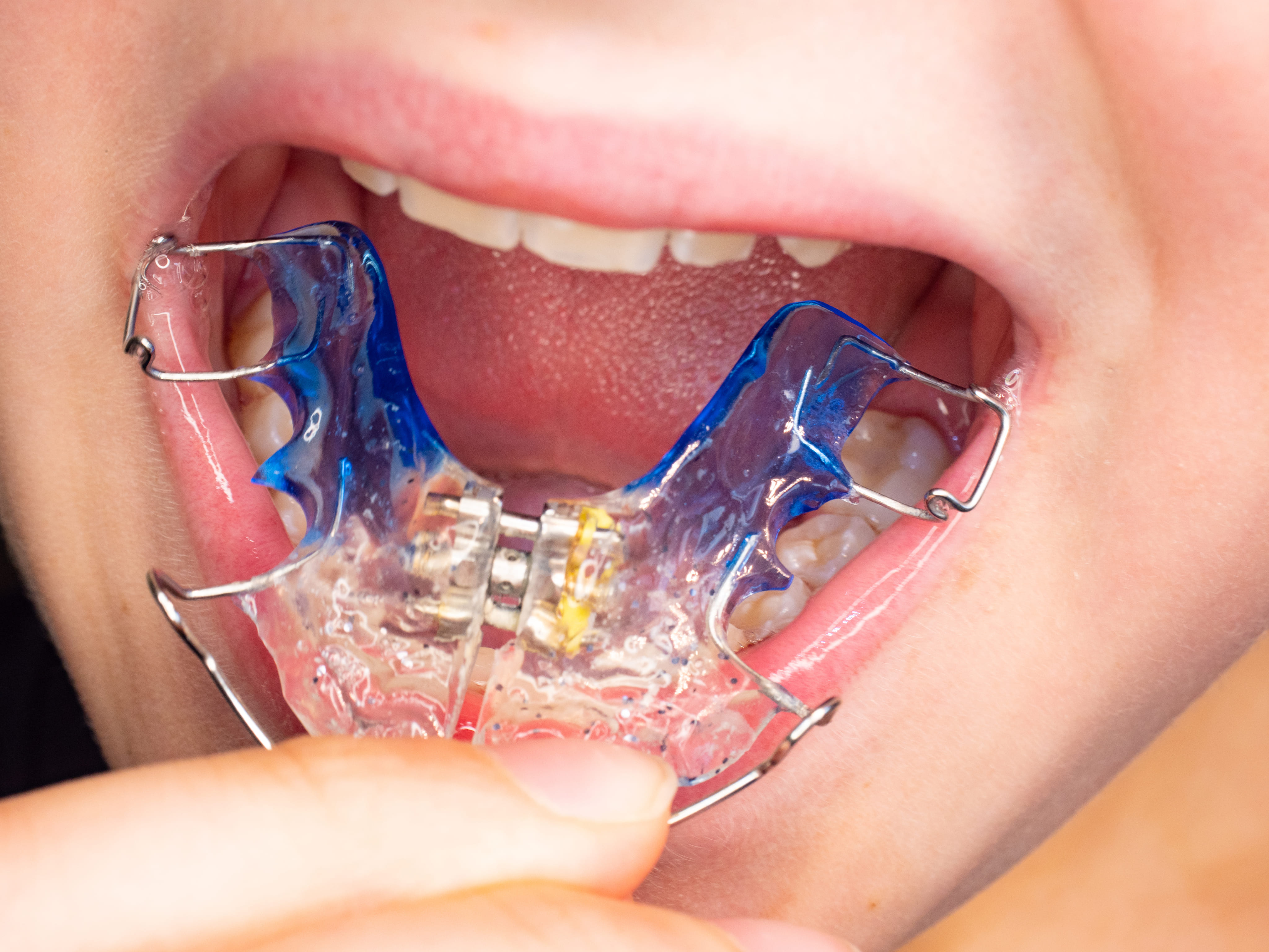 Comment fonctionne ma plaque ?