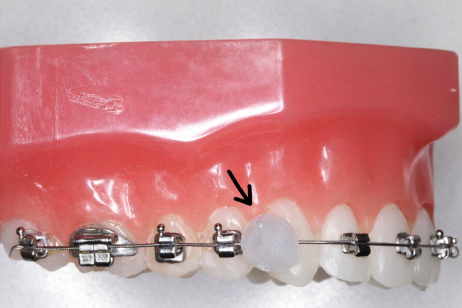 Les urgences orthodotiques