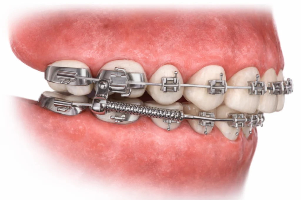 Comment fonctionnent mes bielles ?