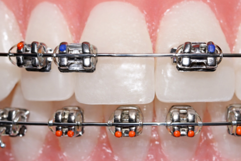 Les urgences orthodotiques