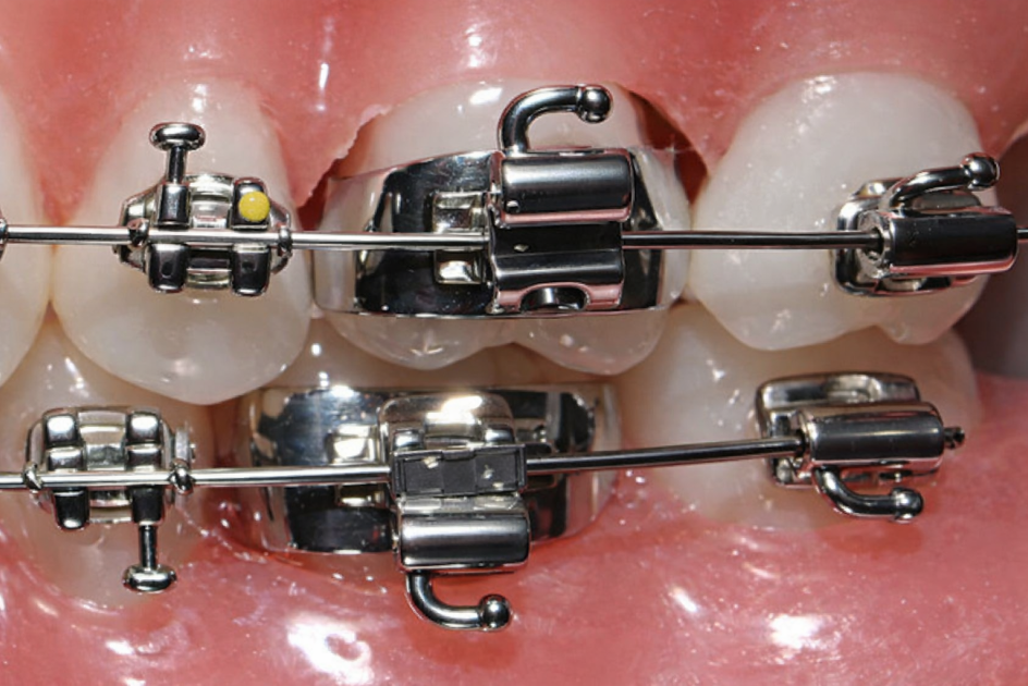 Les urgences orthodotiques