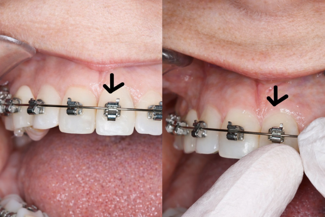 Les urgences orthodotiques