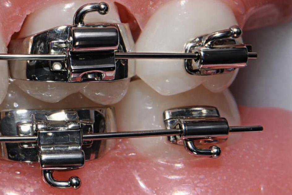 Les urgences orthodotiques