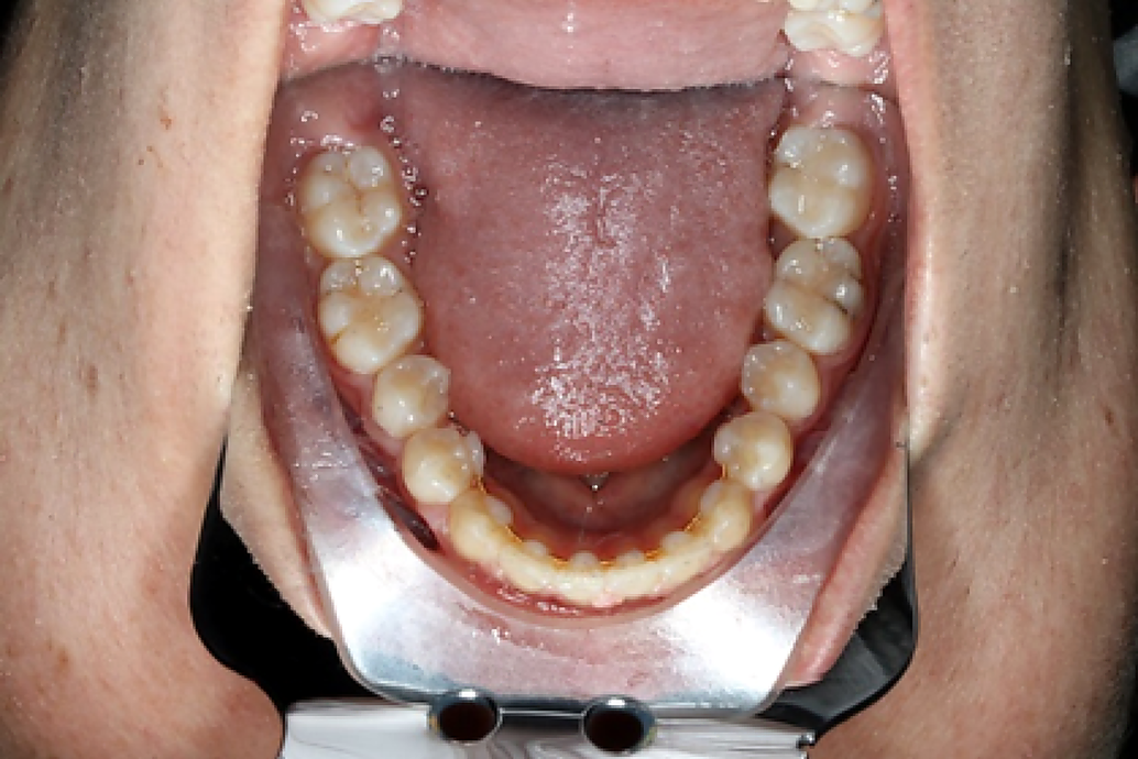 Les urgences orthodotiques