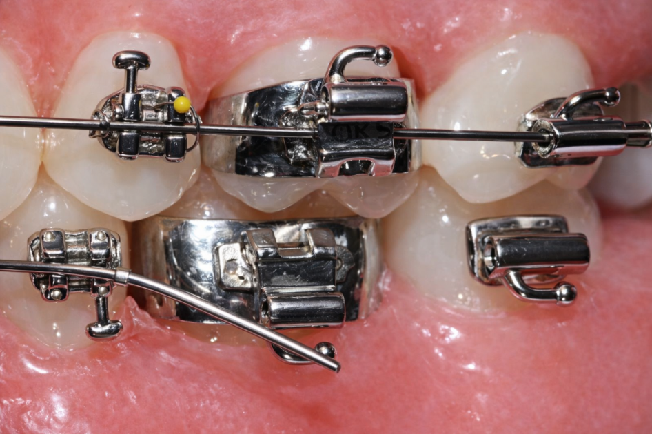 Les urgences orthodotiques