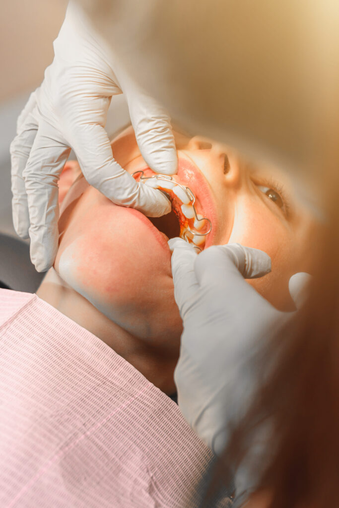 Comment activer mon vérin médian ?