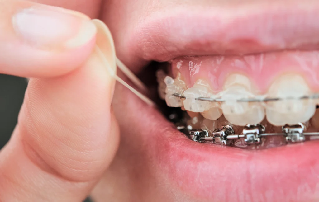 L'Orthodontie au quotidien