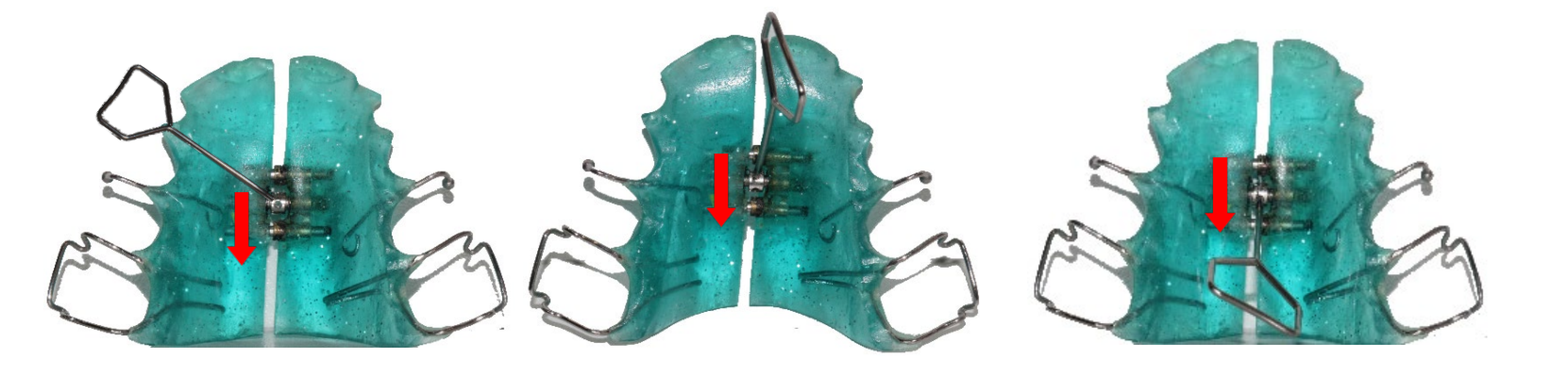 Comment activer mon vérin médian ?