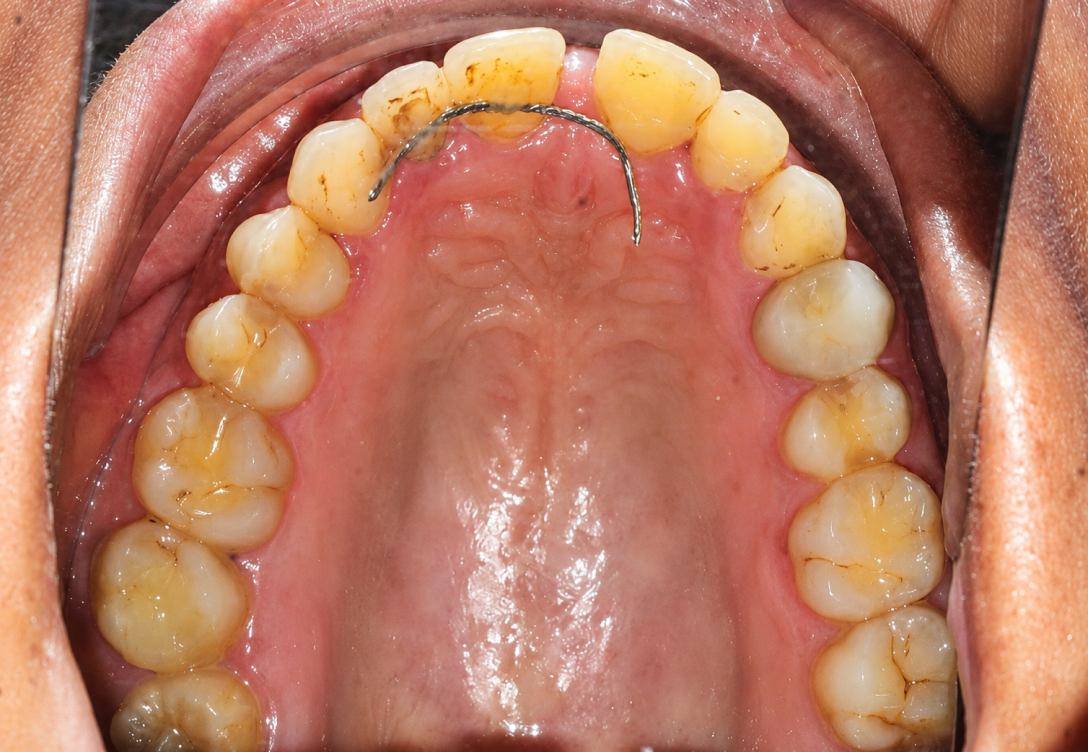 Les urgences orthodontiques